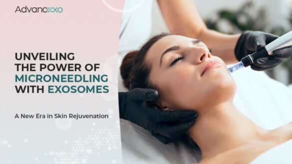 Microneedling-with-Exosomes