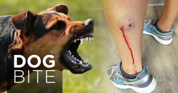 Dog Bite claim Lawyer Perth